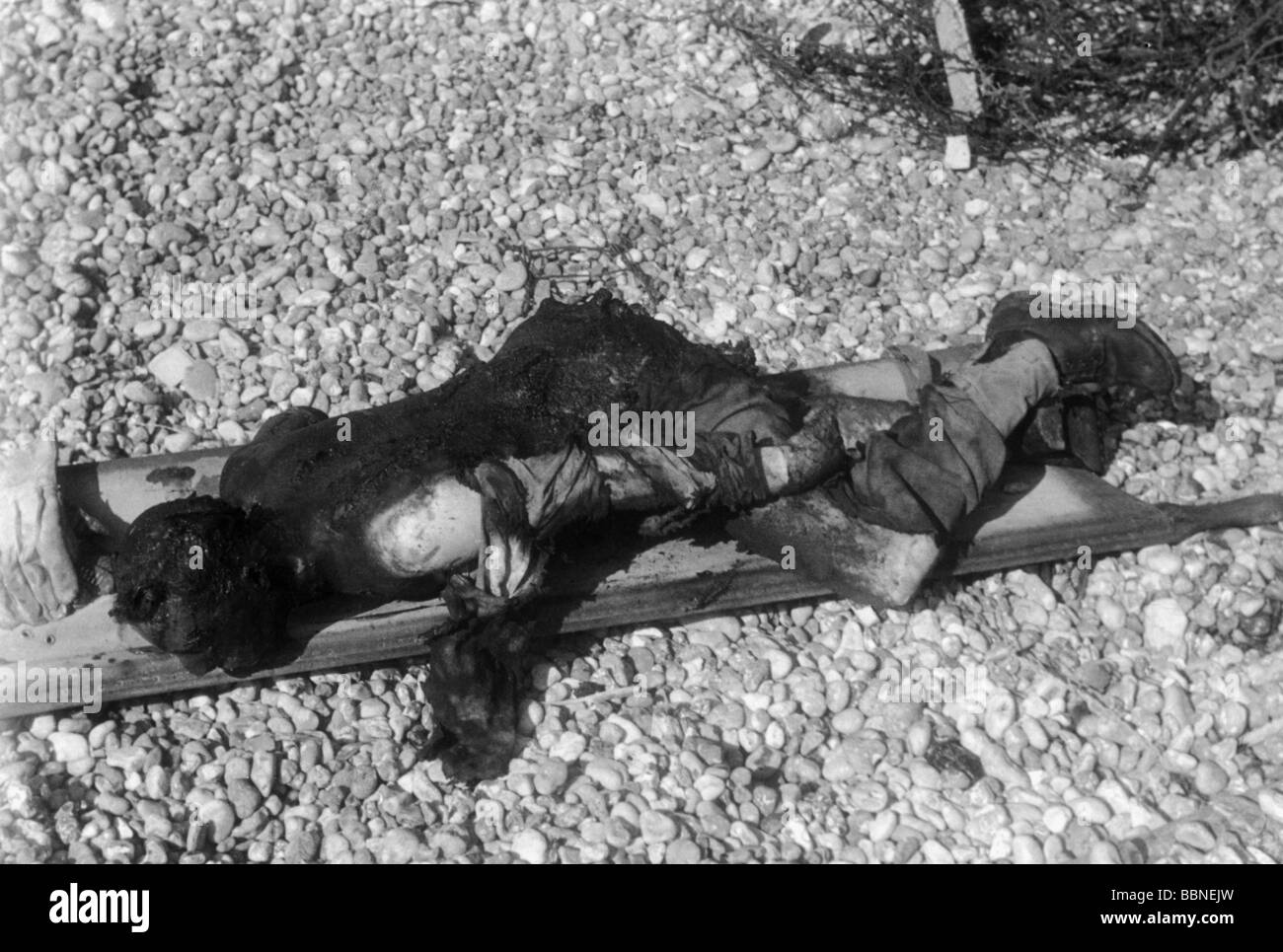 Ereignisse, Zweiter Weltkrieg/Zweiter Weltkrieg, Frankreich, Dieppe, 19.8.1942, verbrannter Soldat auf einer Bahre, Stockfoto