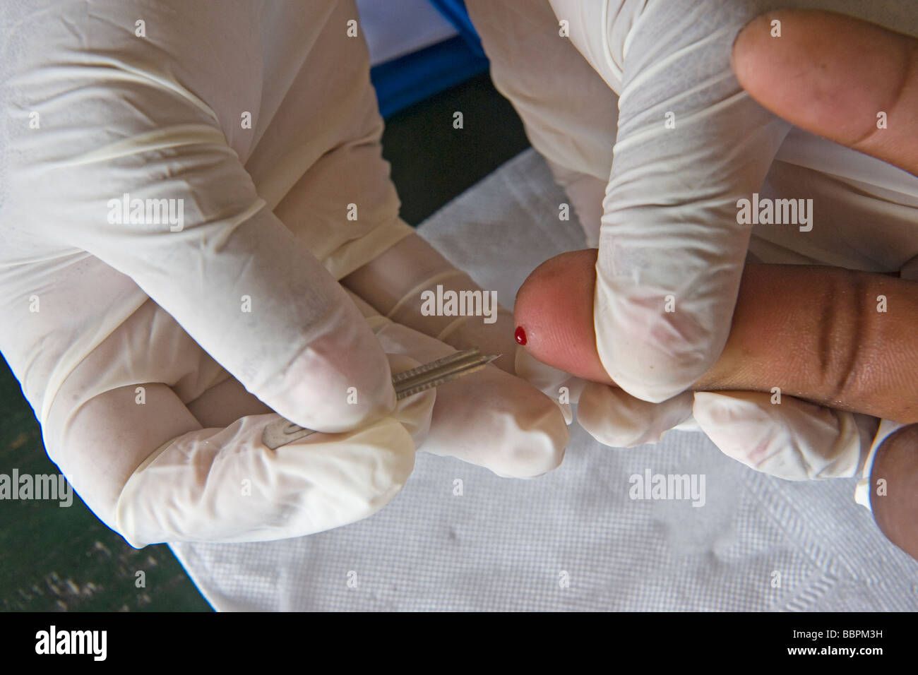 Blutentnahme für HIV-Schnelltest Quelimane Mosambik Stockfoto