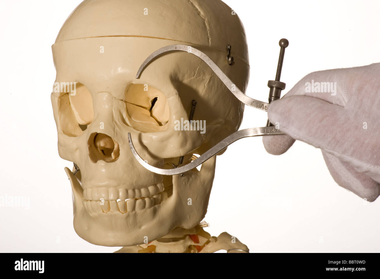 menschlicher Schädel werden Bremssättel gemessen Stockfoto