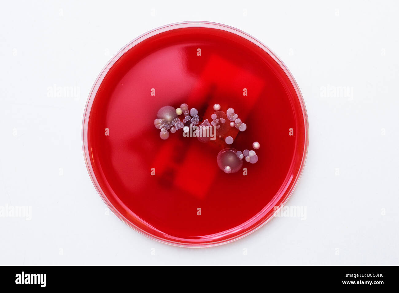 Petrischalen mit Kolonien von Staphylococcus Epidermidis Bacillus & micrococcus Stockfoto