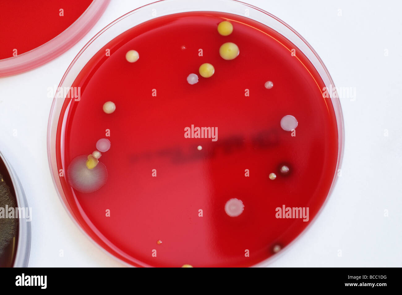 Petrischalen mit Kolonien von Staphylococcus Epidermidis & Staphylococcus aureus Stockfoto