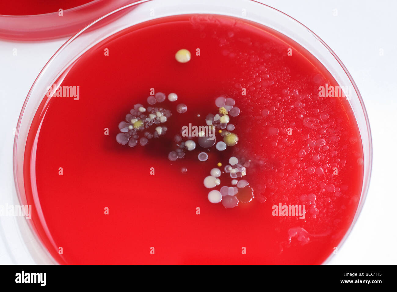 Petrischalen mit Kolonien von Staphylococcus Epidermidis Bacillus & micrococcus Stockfoto