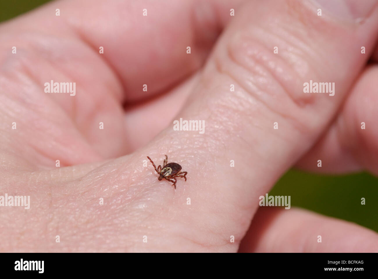 Amerikanische Hündin Zecke Dermacentor Variabilis auch bekannt als der Holzbock ist es auf eine Person s hand Stockfoto