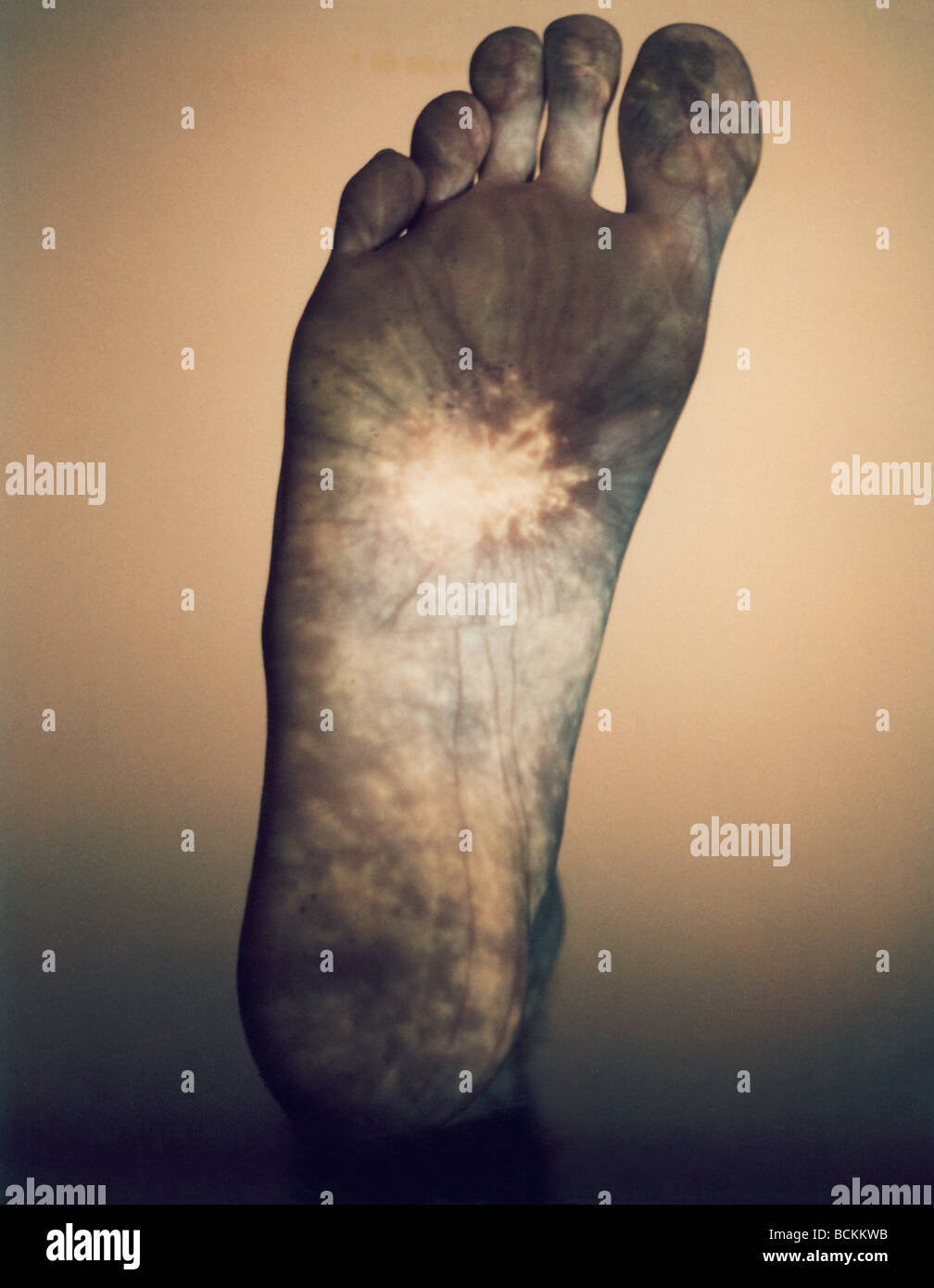 Aching feet -Fotos und -Bildmaterial in hoher Auflösung - Seite 3 - Alamy