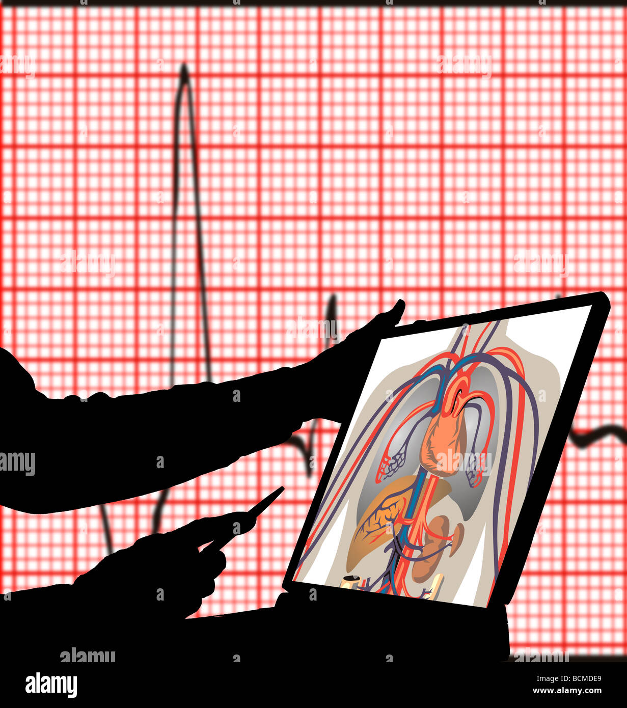 medizinische Techniker Studium arterielle Flow Abbildung auf Laptop-computer Stockfoto