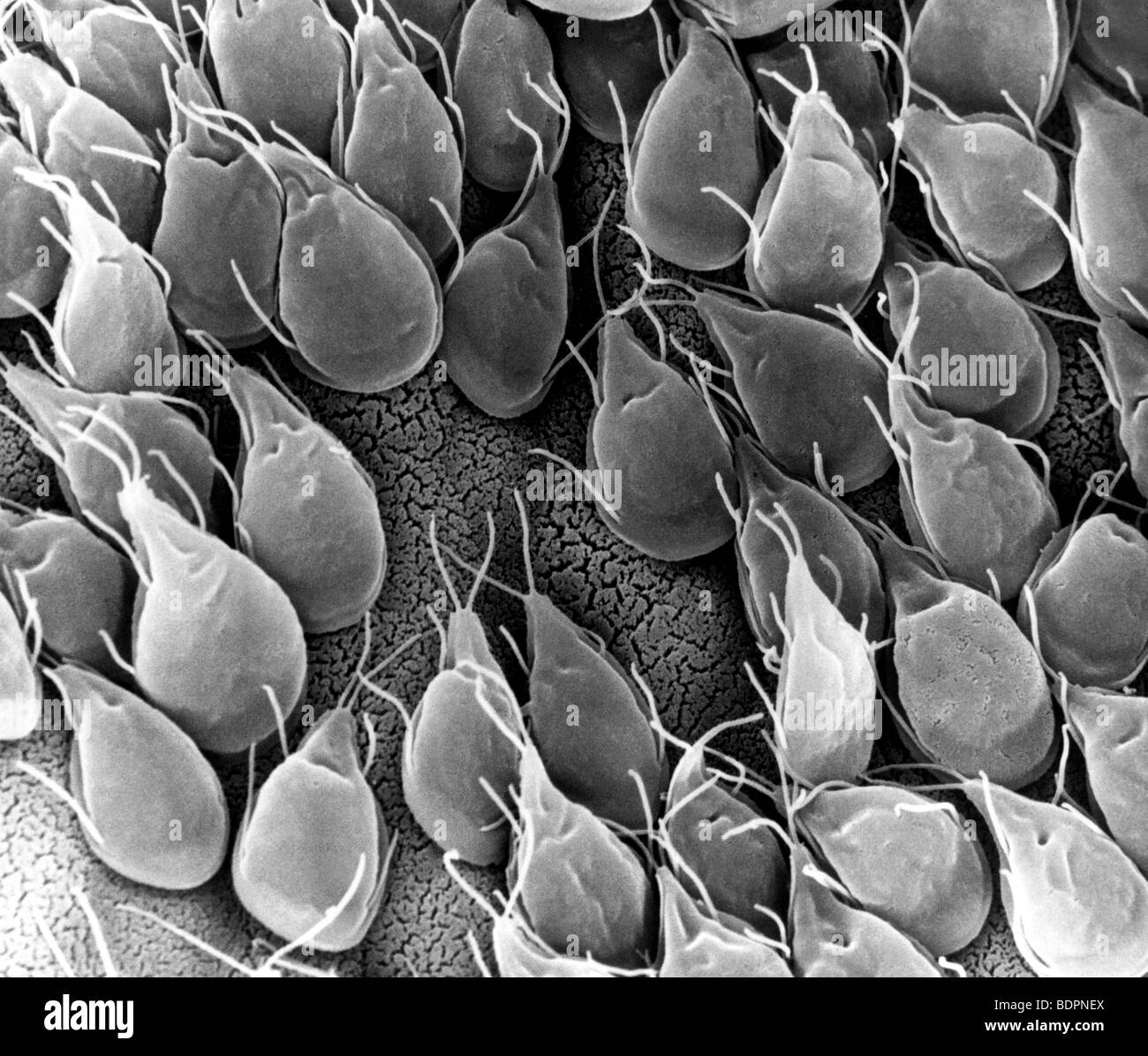 Dieser Scan Elektron Schliffbild (SEM) zeigt die Schleimhautoberfläche des Dünndarms eine Rennmaus mit Giardia befallen Stockfoto