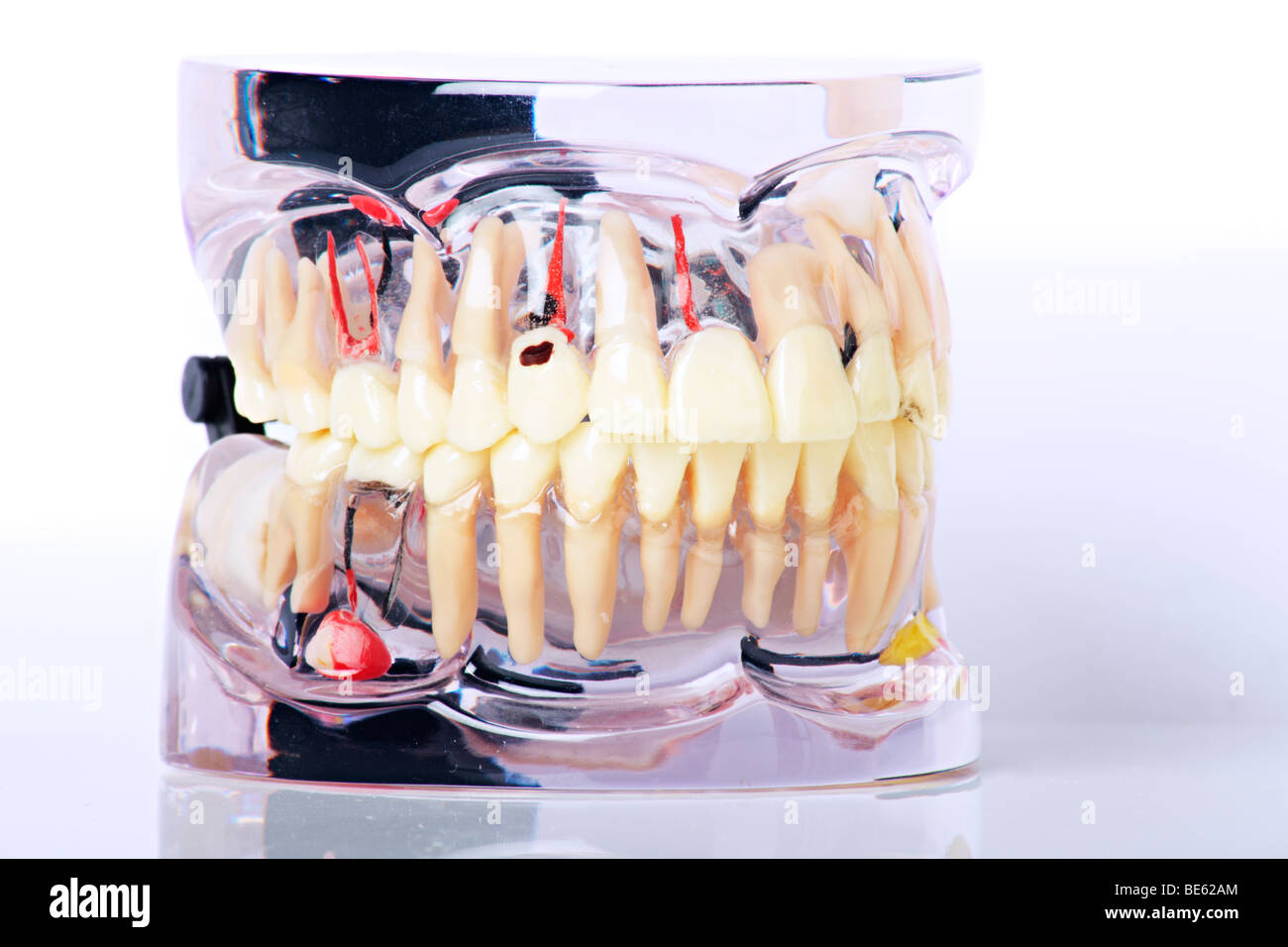 Nahaufnahme von dental-Modell mit Zahnproblemen isoliert auf weißem Hintergrund Stockfoto
