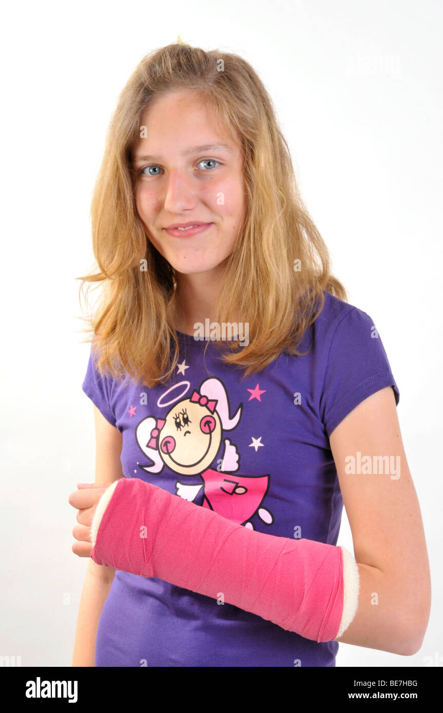 Mädchen mit Gips an einem gebrochenen arm Stockfoto