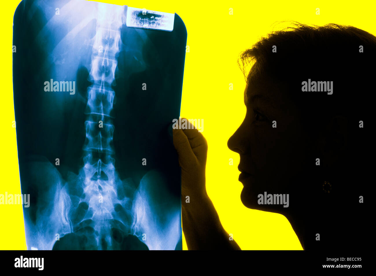 Frau x-ray Techniker prüfen Wirbelsäule Röntgen im Labor Stockfoto