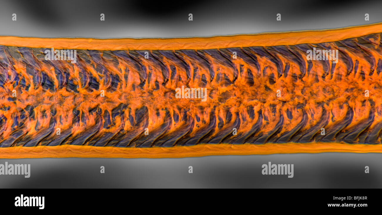 Mikrophotographie der Radula von Immergrün zeigt Zähne wie Bergrücken Stockfoto