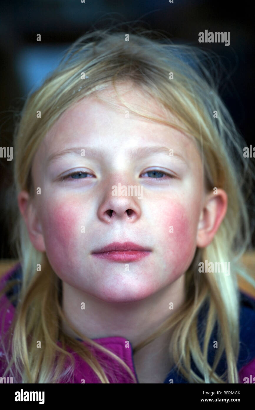 Eine blasse Wangen rosig sechs Jahres altes Mädchen Grimassen. Stockfoto