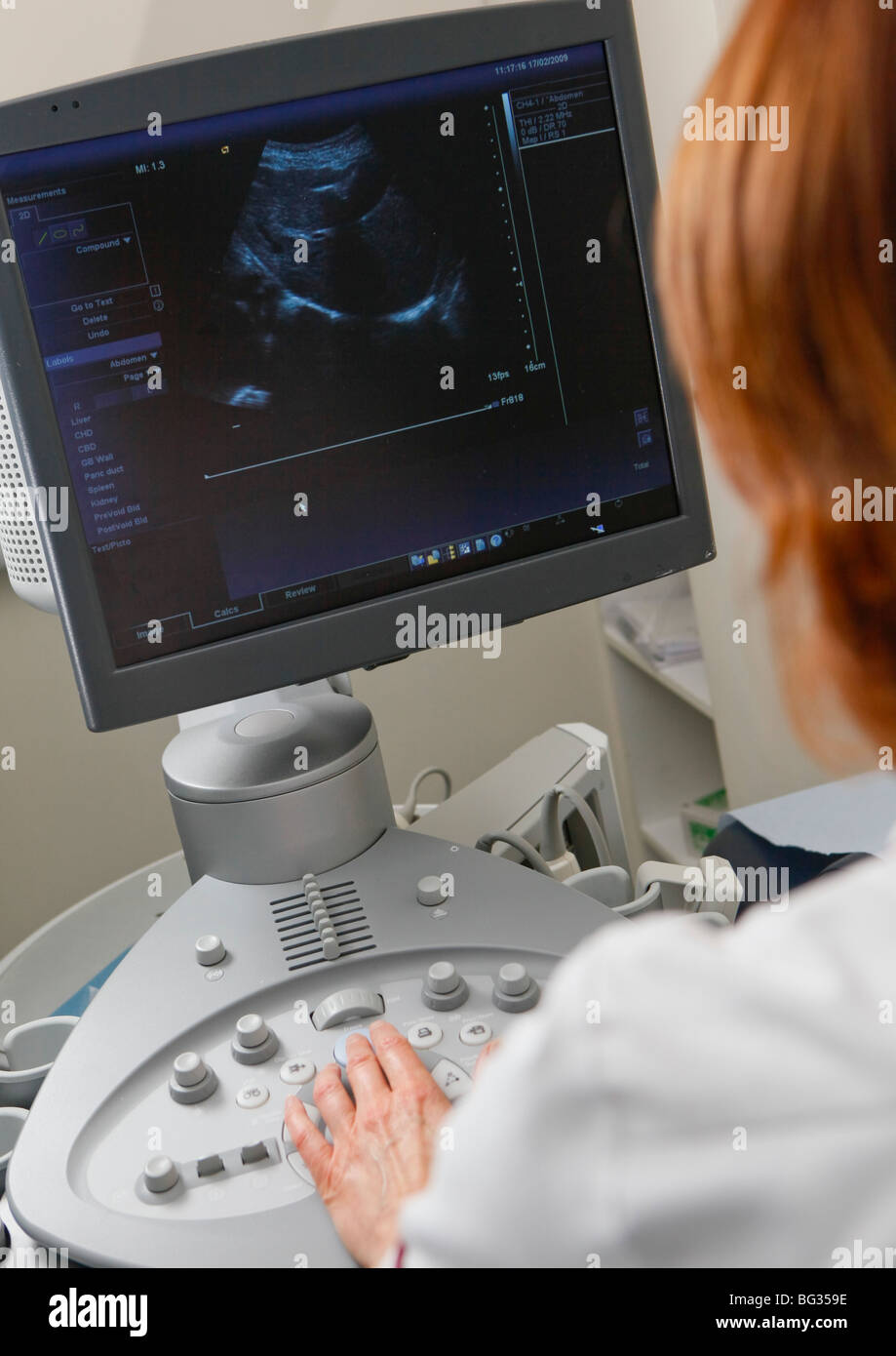 Ultraschalluntersuchung von einer Krankenschwester in einem Krankenhaus. Stockfoto