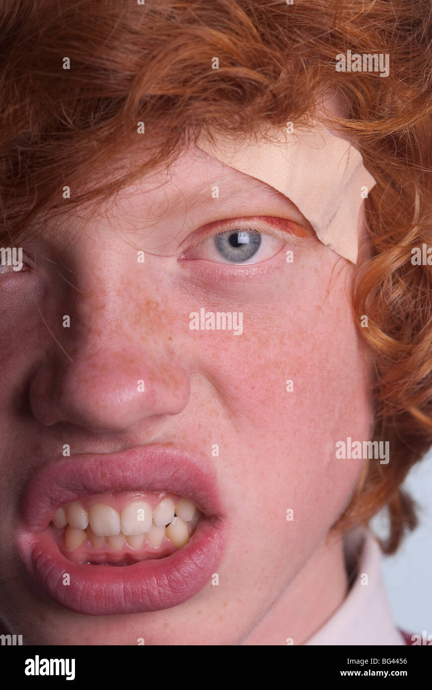 Ginger behaarte Teenager mit einem Pflaster über dem Auge schwarz Stockfoto