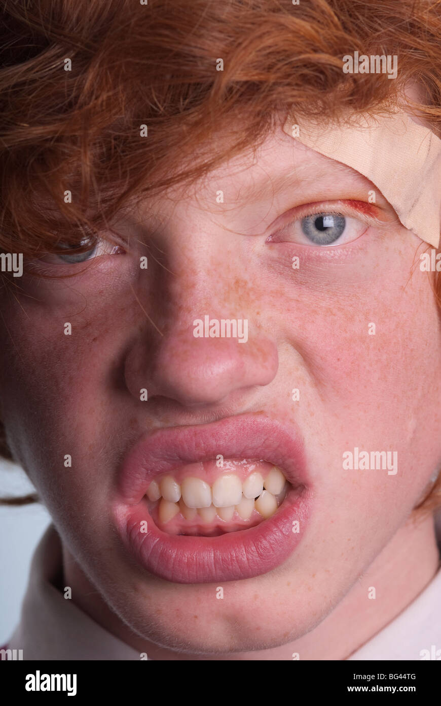 Ginger behaarte Teenager mit einem Pflaster über dem Auge schwarz Stockfoto