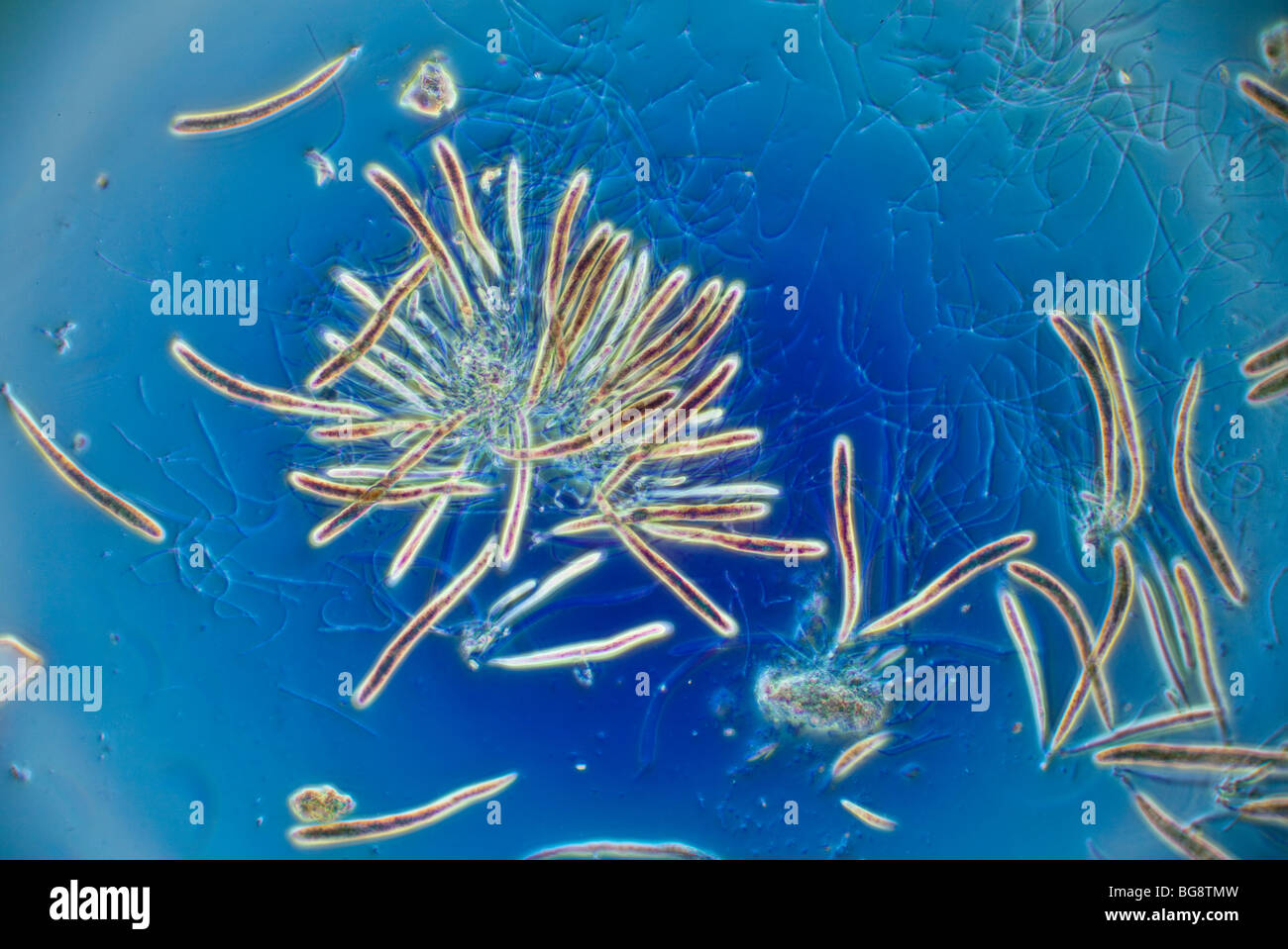 Mikrophotographie Leptosphaeria Acuta Pilz, blauer Hintergrund Stockfoto