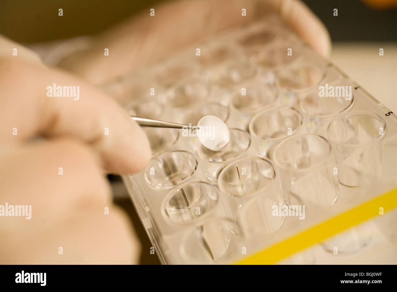Krebs-Forscher-Hospital St. Louis, Paris, eine öffentliche Hilfen Krankenhaus Foto von Owen Franken Stockfoto