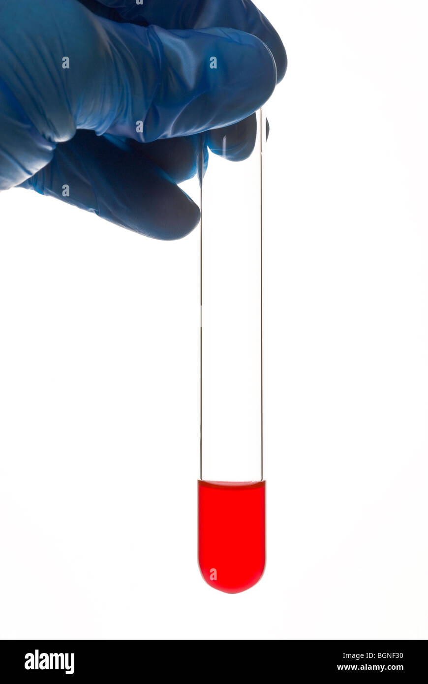 blaue behandschuhten Hand hält Reagenzglas mit roten Muster Stockfoto