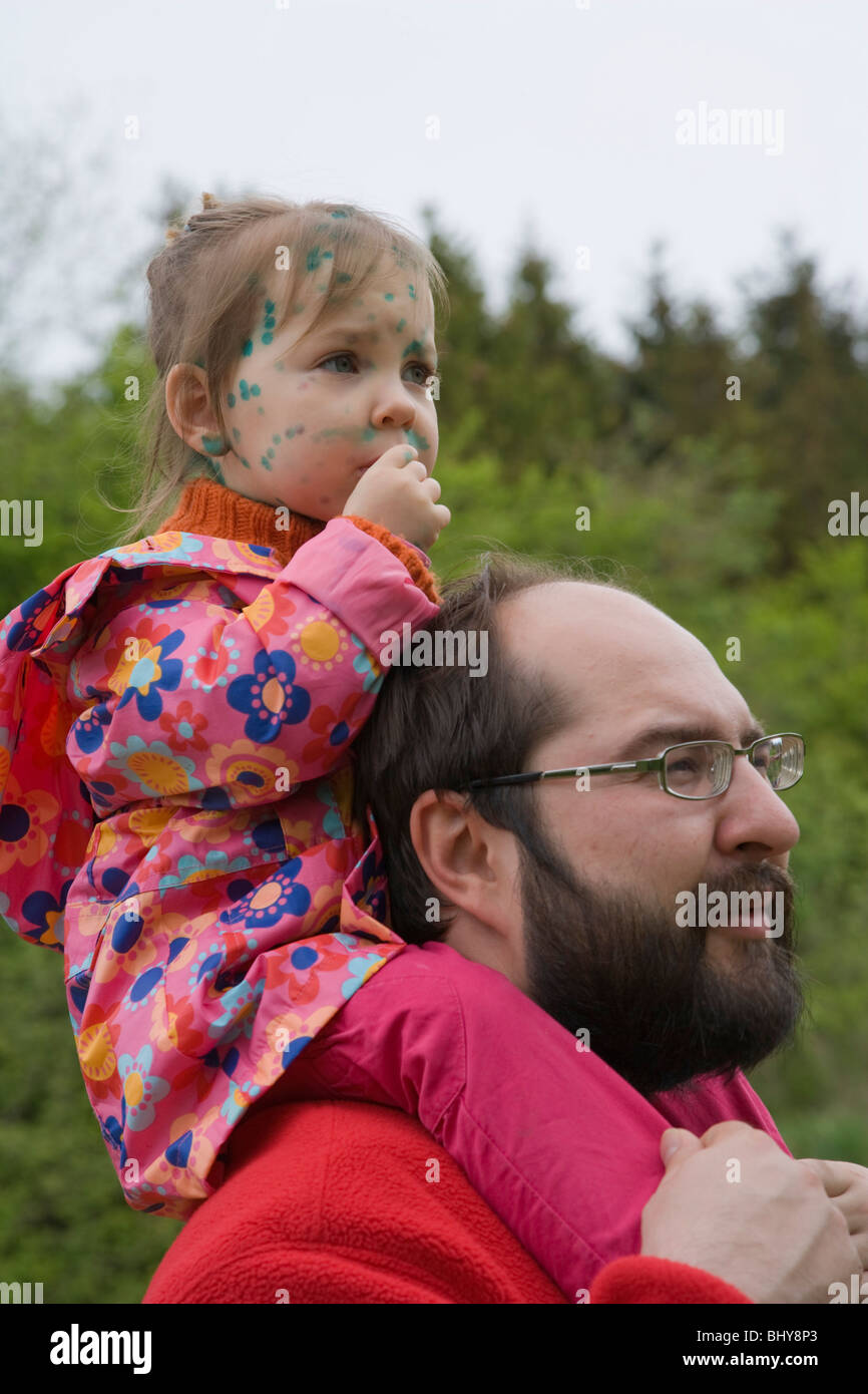 Kleinkind Mädchen auf Papa. Windpocken. Frühling. Stockfoto