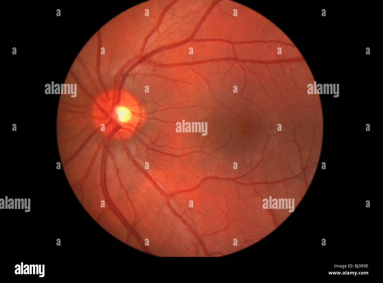 Medizinische Bildverarbeitung im Inneren des menschlichen Auges zeigt der Netzhaut Stockfoto