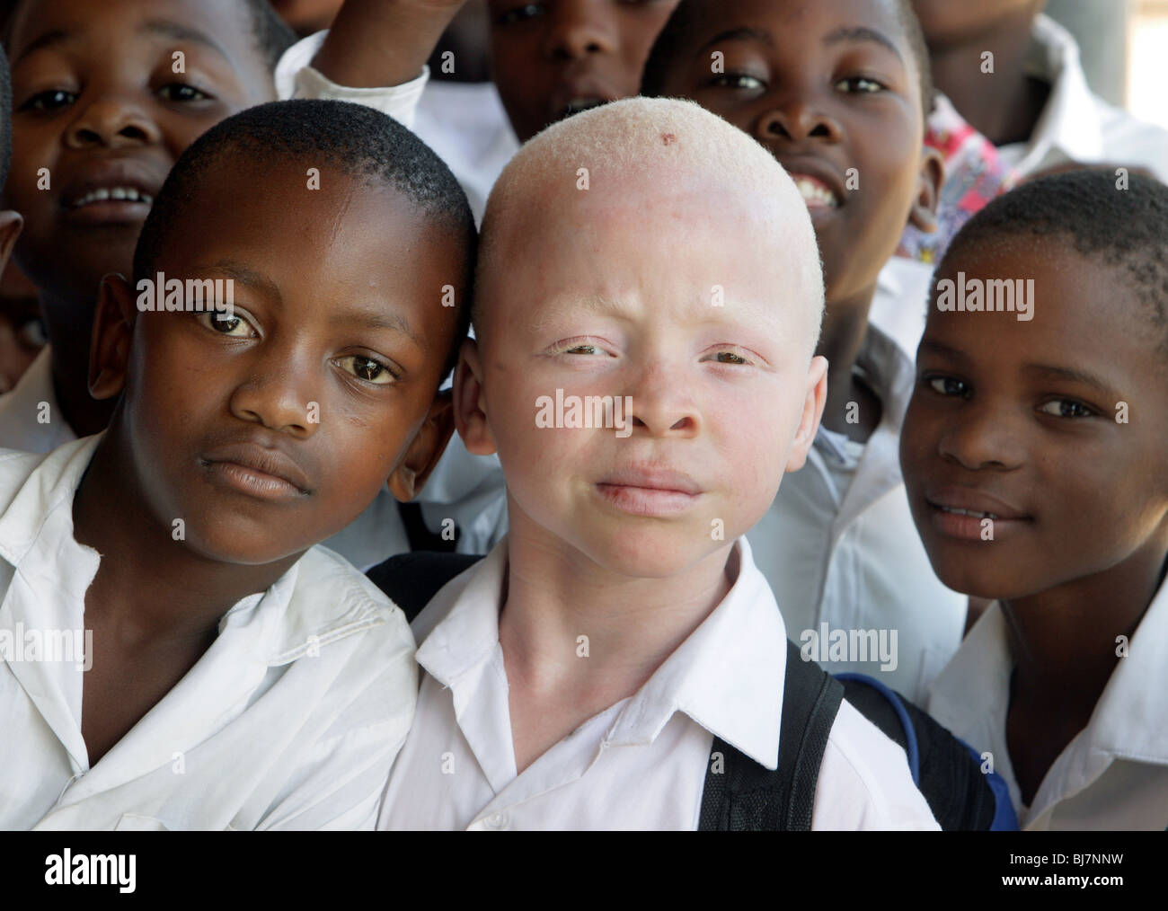 Südafrika - junge Albino mit schwarzen Schülern an einer Schule in Mariannhill. In Afrika ist die Verfolgung von Menschen mit Albinismus nicht ungewöhnlich. Stockfoto