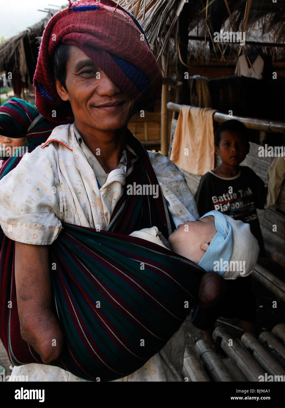 Deaktivierte Karen Flüchtling ohne Hände mit Baby, Umpium Flüchtlingslager (thai-burmesischen Grenze), südlich von Tak, Mae Sot, thailand Stockfoto
