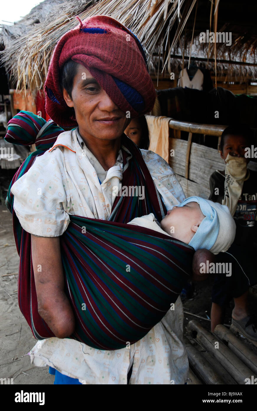 Deaktivierte Karen Flüchtling ohne Hände mit Baby, Umpium Flüchtlingslager (thai-burmesischen Grenze), südlich von Tak, Mae Sot, thailand Stockfoto