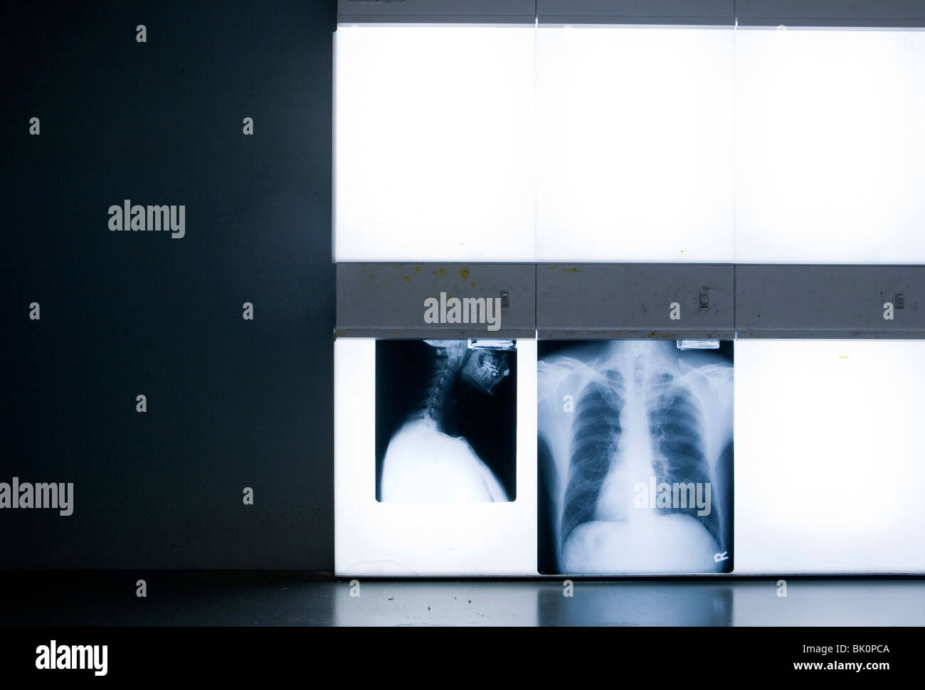 Röntgenstrahlen in einer Arztpraxis. Stockfoto