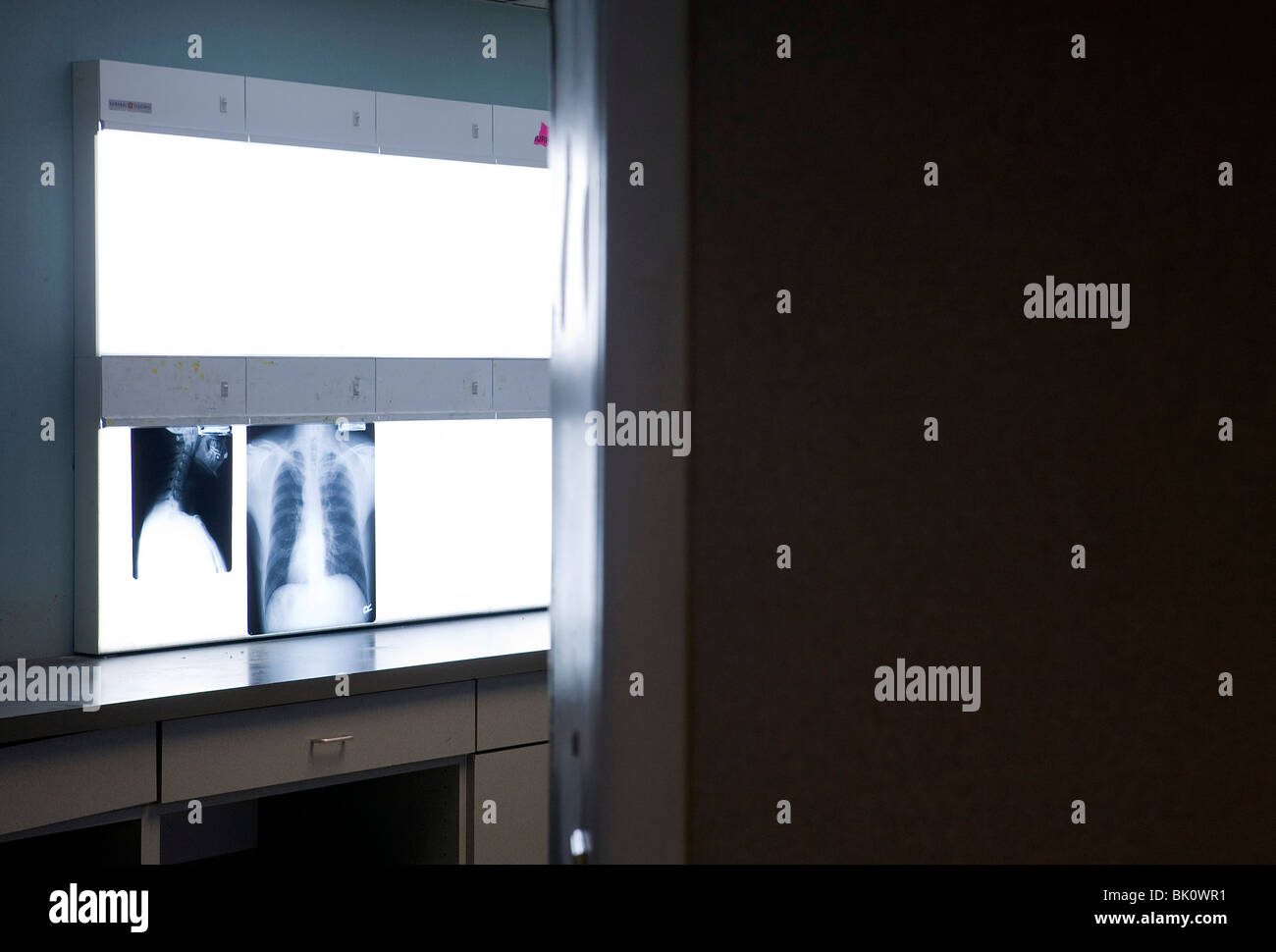 Röntgenstrahlen in einer Arztpraxis. Stockfoto