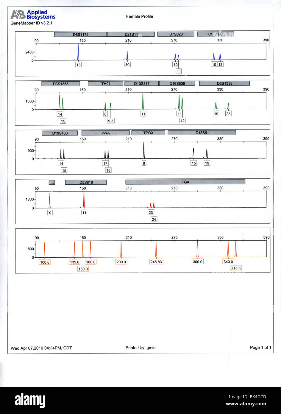 Weibliche DNA Profil Ausdruck. Gedruckt von der Nebraska State Police Crime Lab. Stockfoto