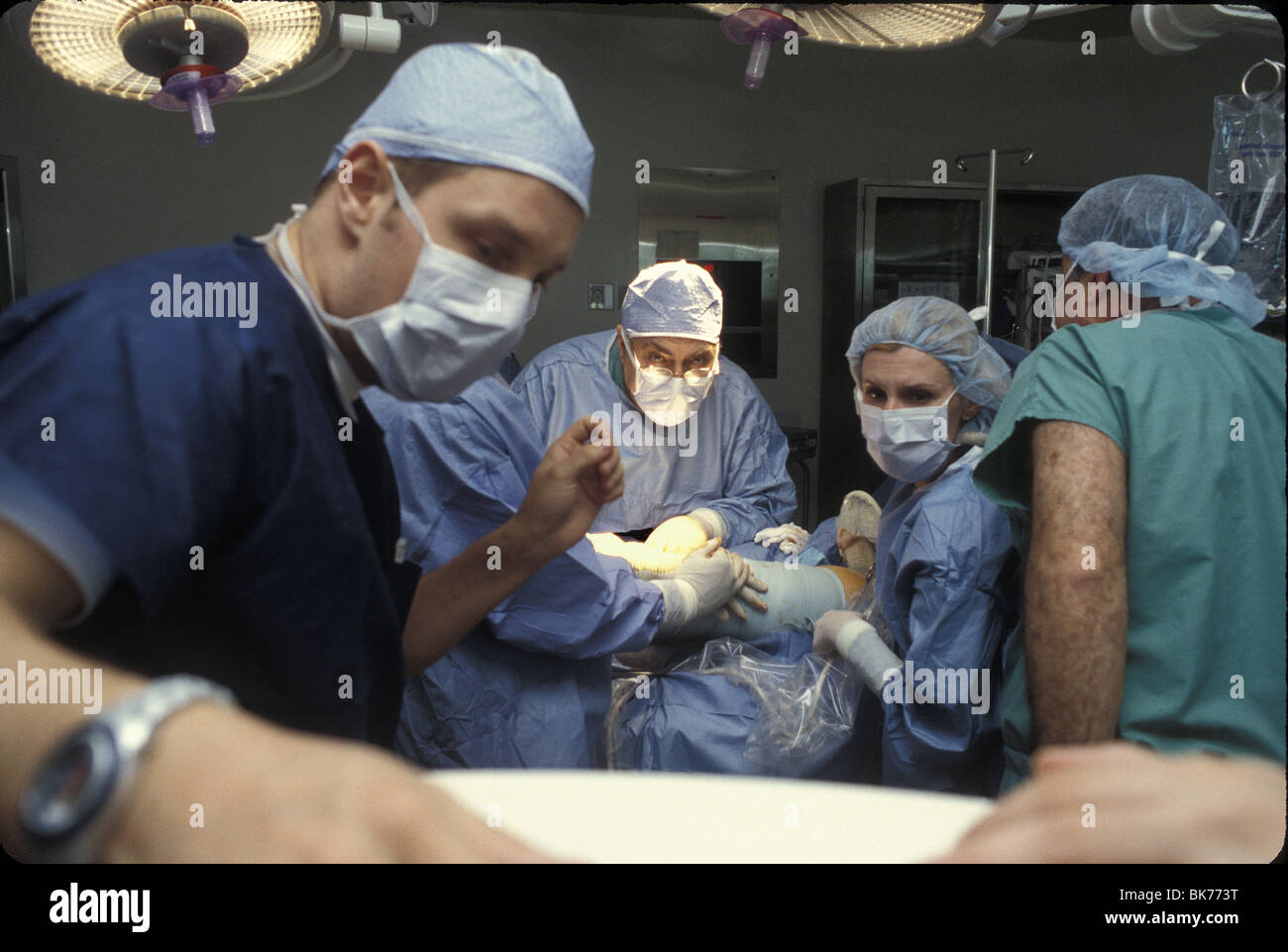 Spezielle Chirurgie für Krampfadern. Chirurg und Team in Monitor sehen in den Körper durch eine sehr kleine Kamera suchen. Stockfoto