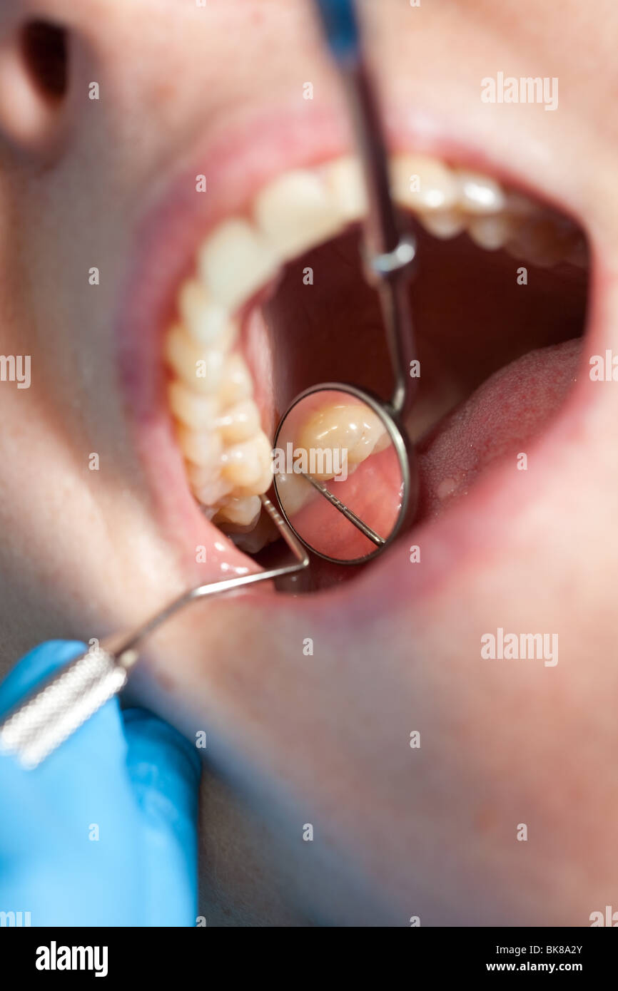 Zahnarzt das Zahnfleisch ihrer Patienten zu überprüfen Stockfoto