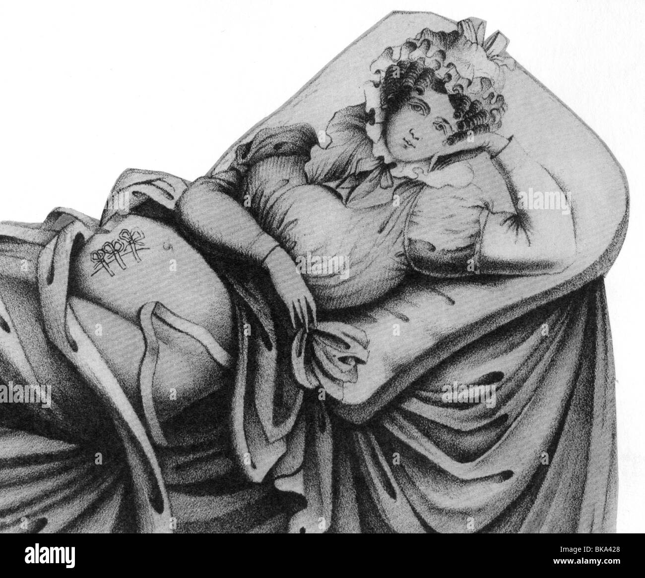 Medizin, Geburt, Frau im Kinderbett, mit Kaiserschnitt, halbe Länge, Druck nach Eduard Caspar von Siebold, 1829, Stockfoto
