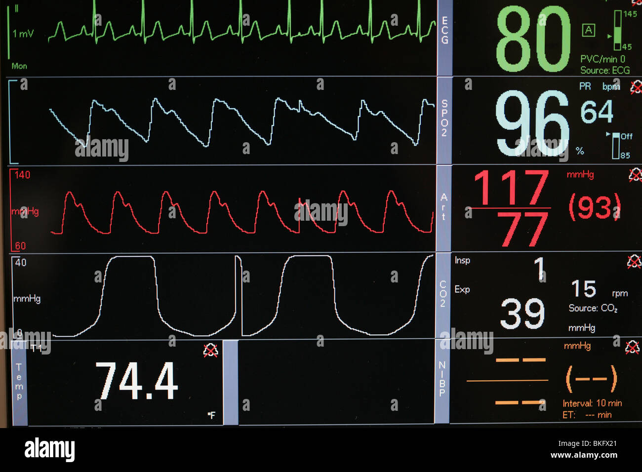 Vitalparameter-Monitor Bildschirm Nahaufnahme Stockfoto
