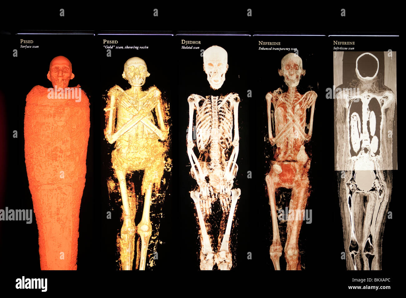 Scans der skelettartigen Mumifizierung wie von den antiken Ägyptern getan Stockfoto
