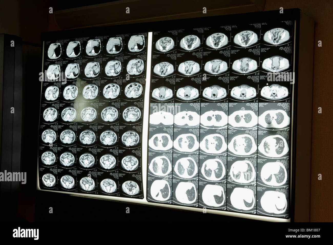 Nahaufnahme von MRI-Scan-Bericht Stockfoto