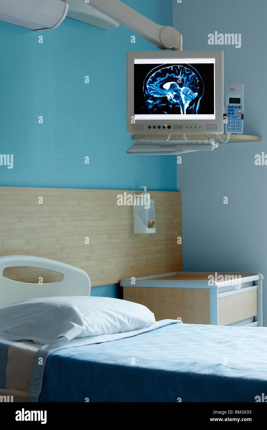 MRI scan des Gehirns auf einem Computerbildschirm in eine Krankenstation Stockfoto