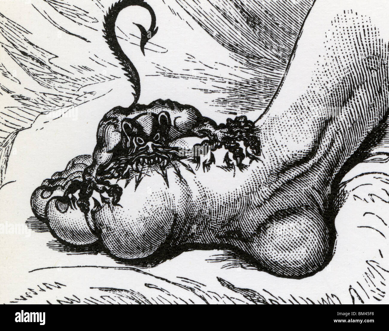 Gicht - eine Karikatur aus dem 18. Jahrhundert Stockfoto