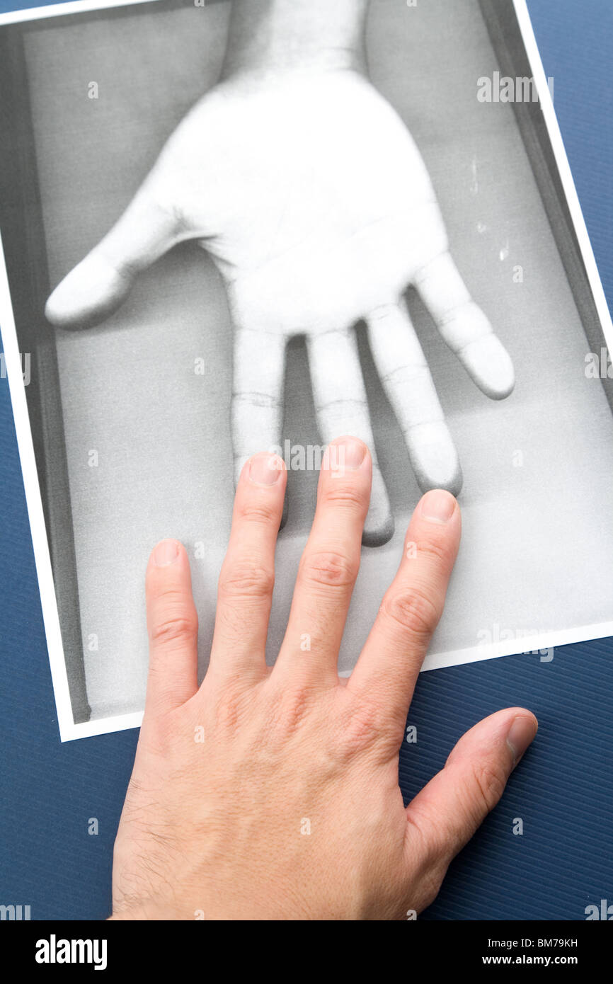 Schwarz / Weiß Kopie von Hand, Konzept der Seele oder spirituelle Kommunikation Stockfoto
