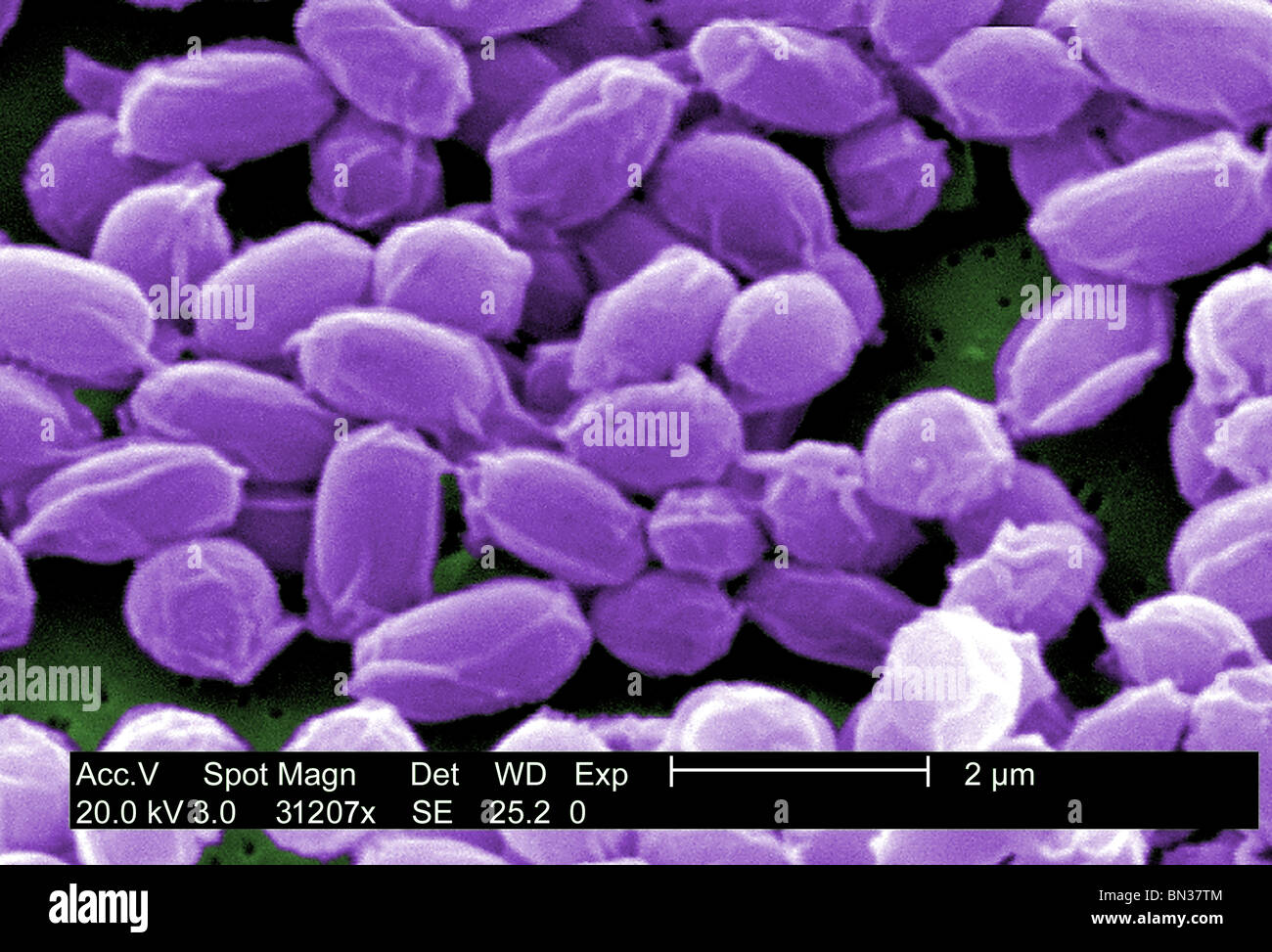 SEM der Anthrax-Bakterien-Sporen (Bacillus Anthracis) Stockfoto