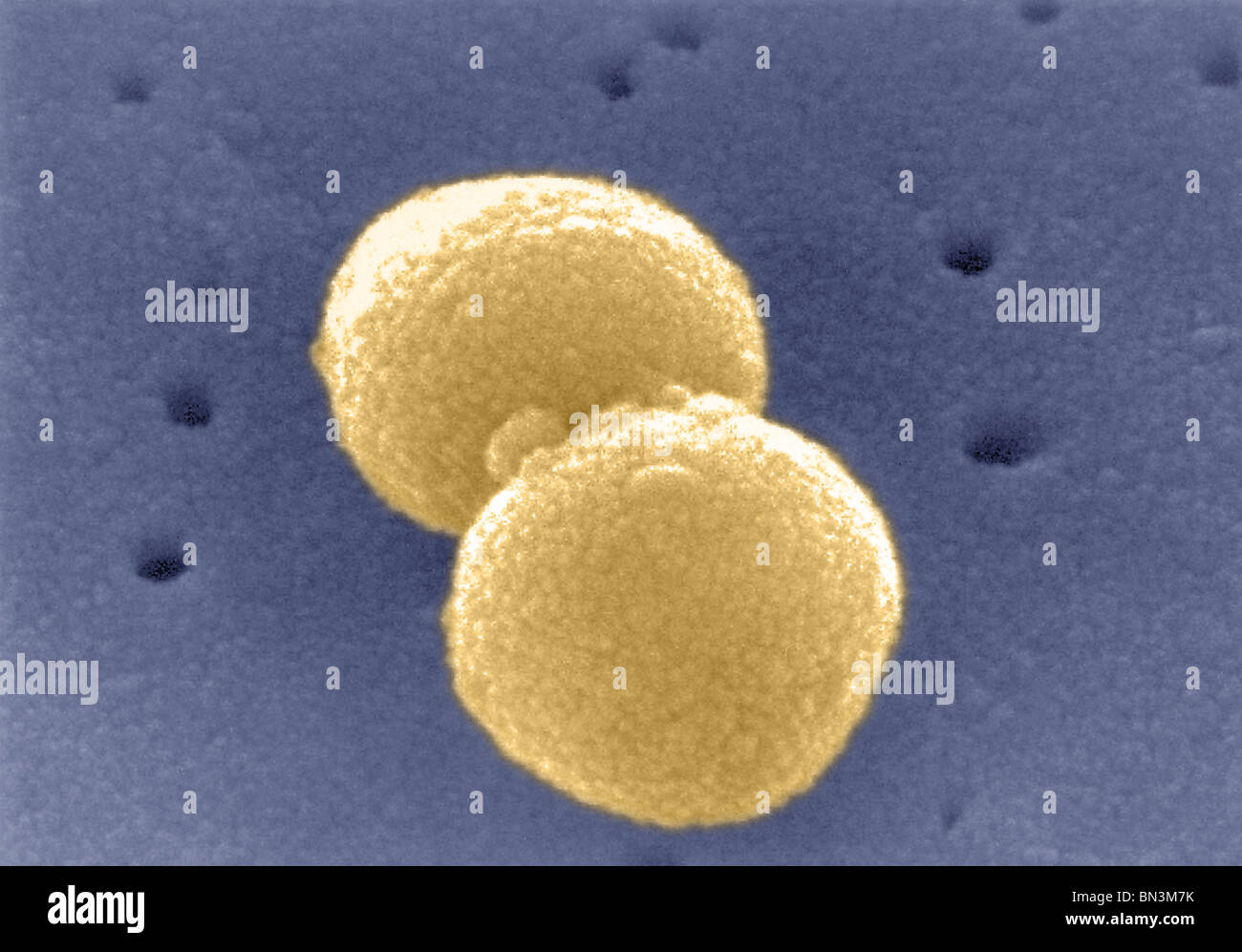 Scanning Electron Schliffbild (SEM) von Gram-positiven Streptococcus Pneumoniae Bakterien Stockfoto