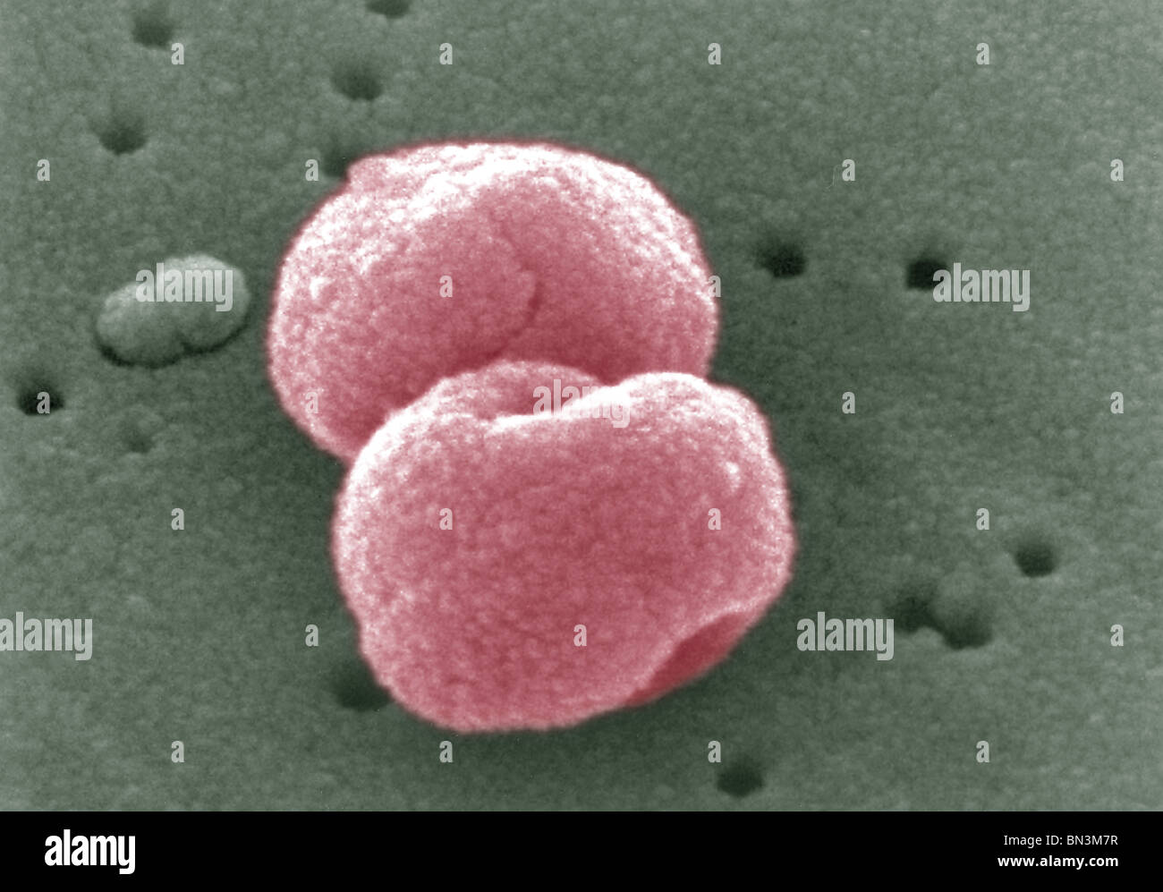 Scanning Electron Schliffbild (SEM) von Gram-positiven Streptococcus Pneumoniae Bakterien Stockfoto