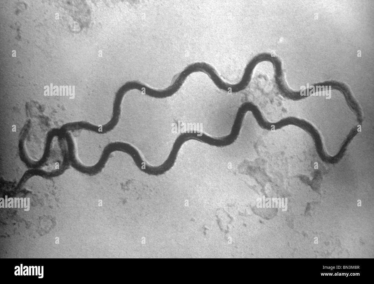 Ein Elektron Mikrophotographie von zwei spiralförmige Treponema Troponema Bakterien, vergrößerte 36.000 X Stockfoto