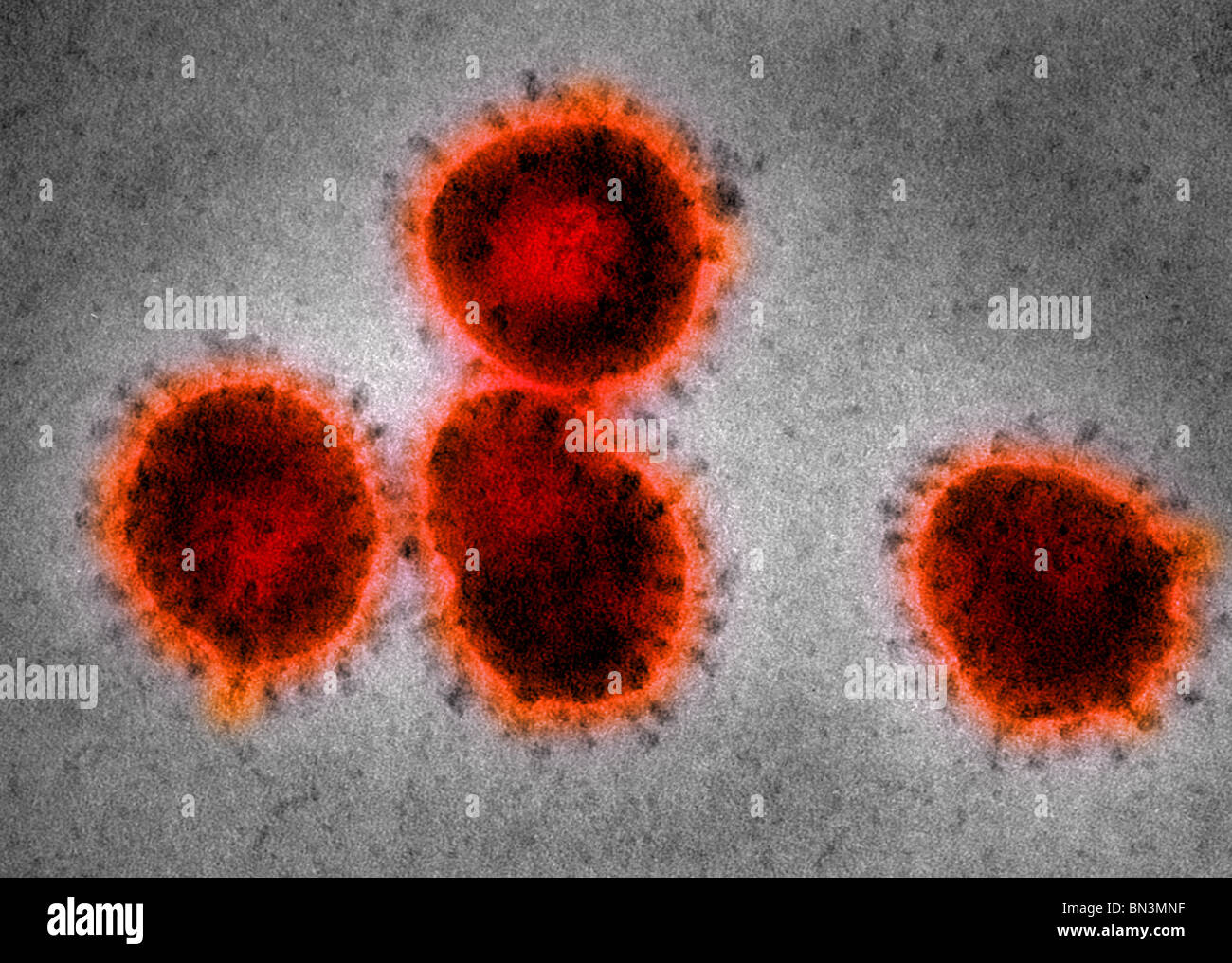 Elektron Schliffbild des Coronavirus, die Ursache der schwere akute respiratorische Syndrom (SARS) Stockfoto