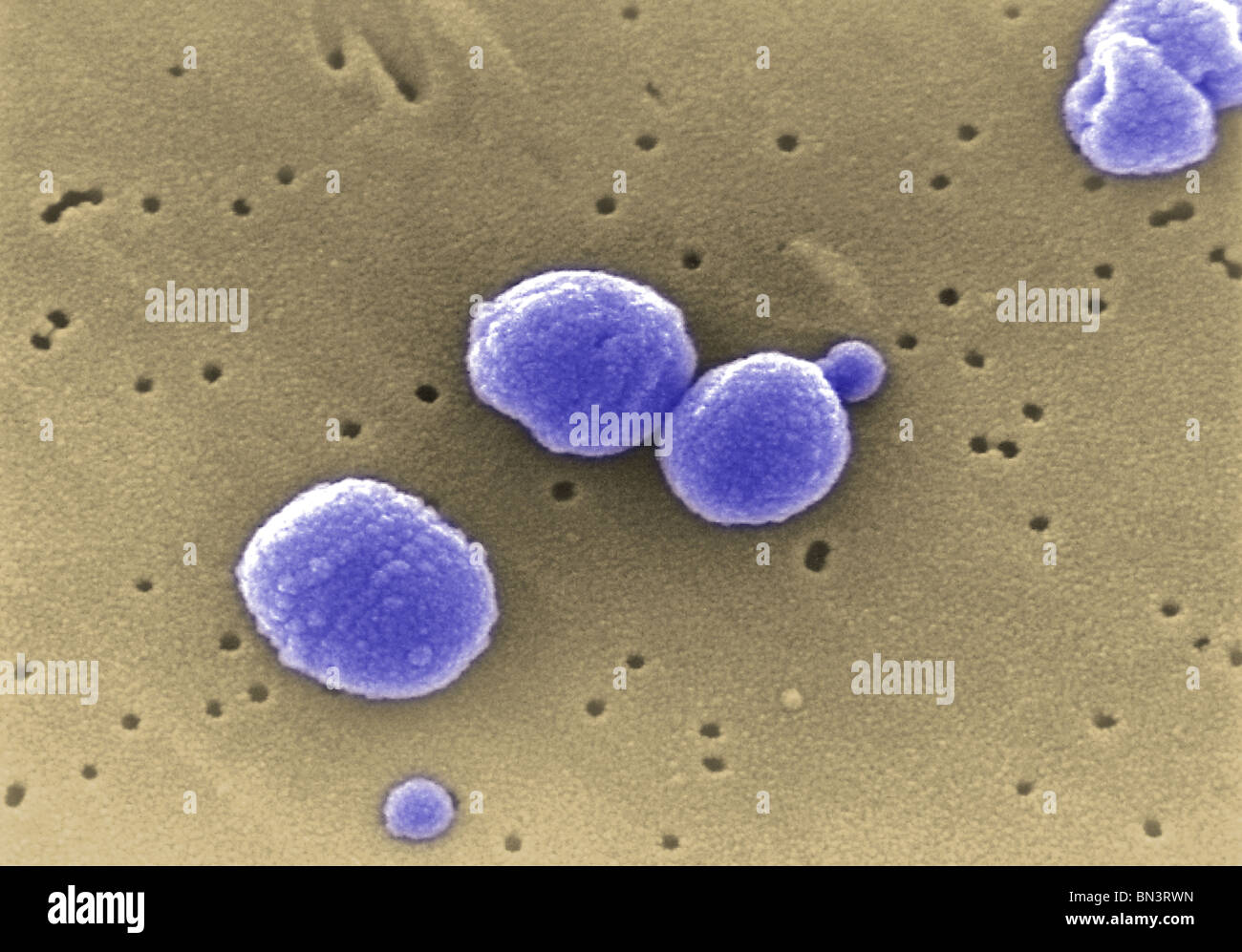 Scanning Electron Schliffbild (SEM) von Gram-positiven Streptococcus Pneumoniae Bakterien Stockfoto