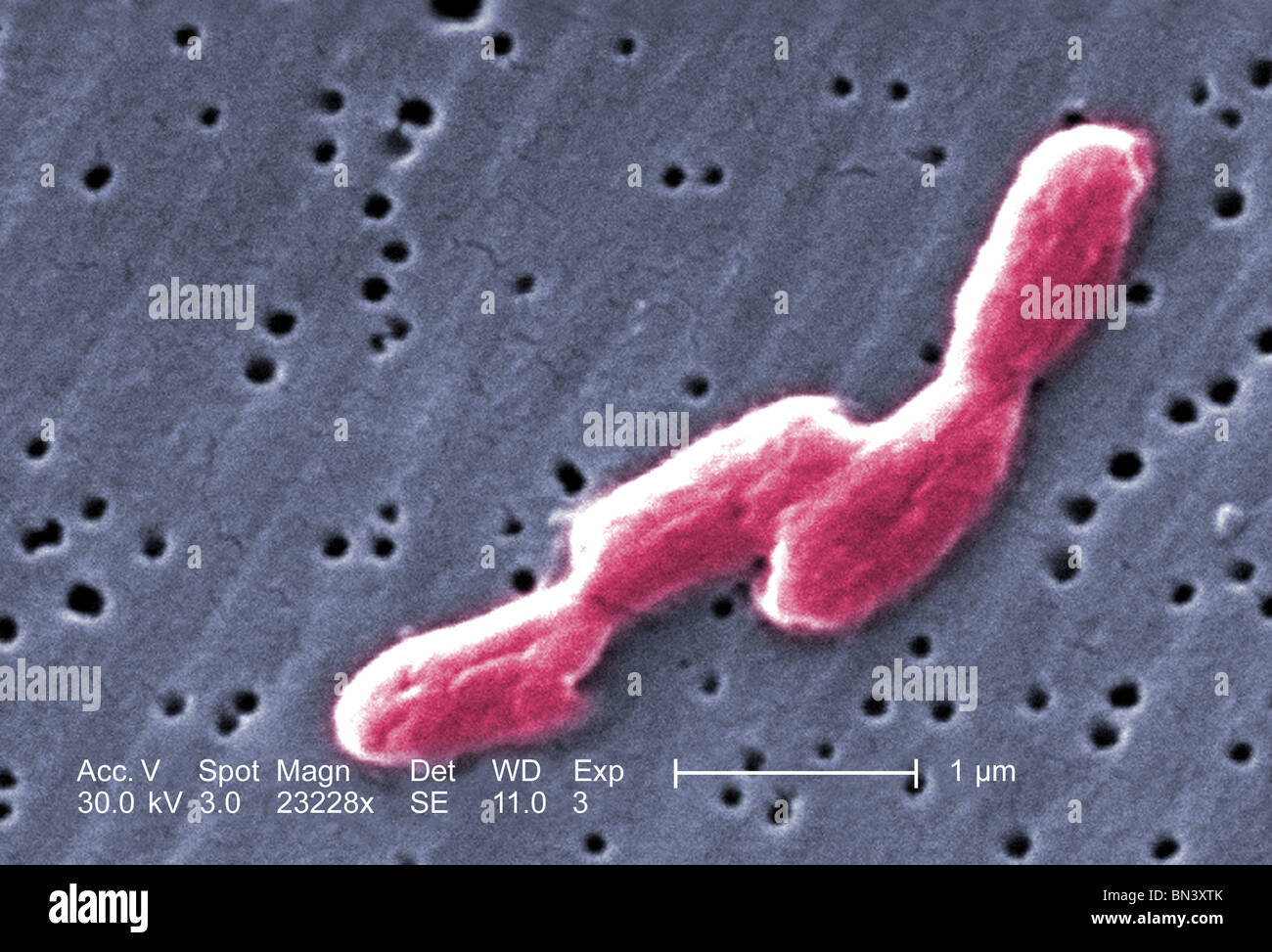 Scanning Electron Schliffbild (SEM) von vier sehr vergrößert, stabförmige, bewegliche, gramnegative Salmonella Infantis Bakterien Stockfoto