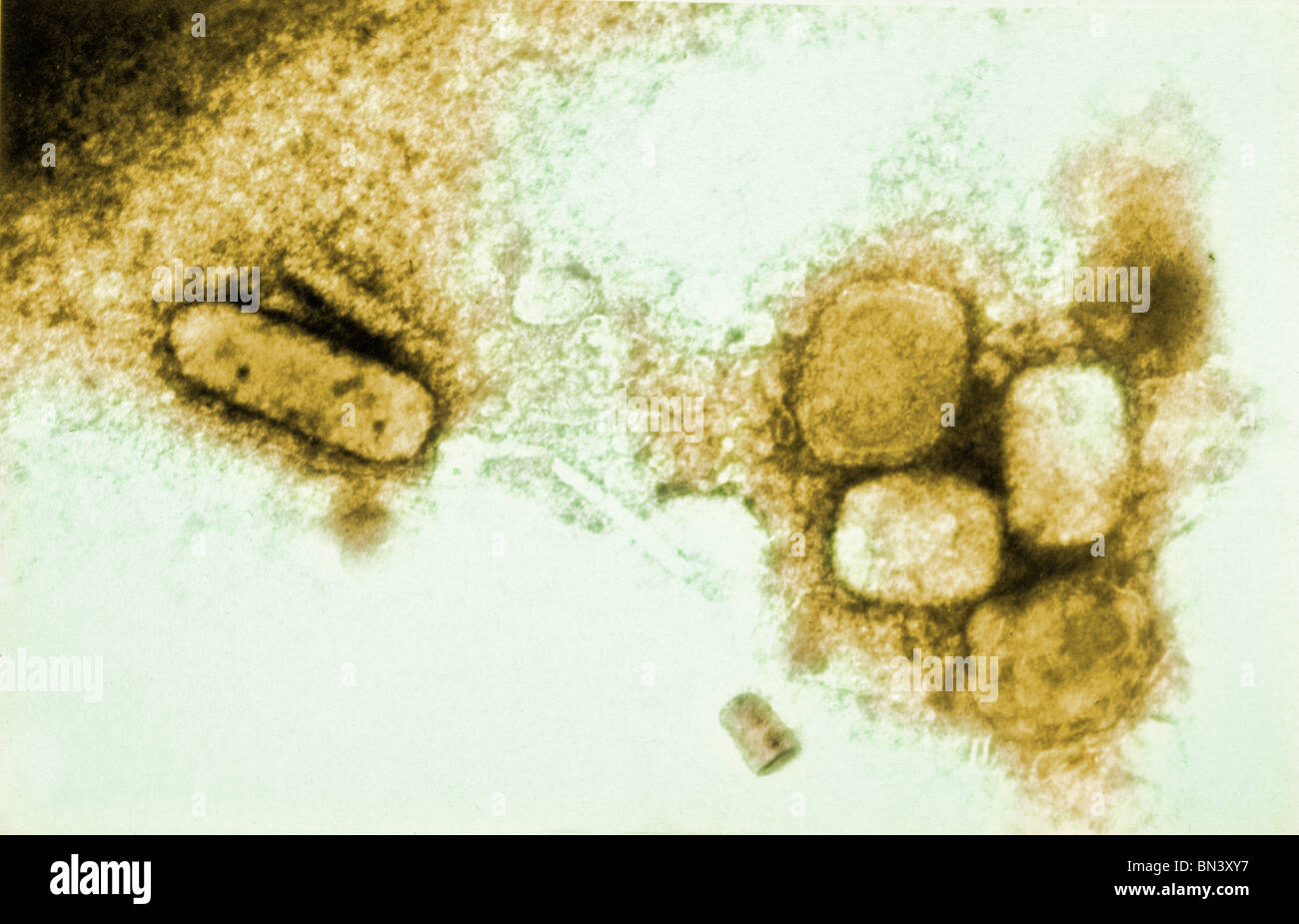 Transmission Electron Schliffbild der Variola, das Pockenvirus mit einer negativen Fleck-Technik; Vergrößerung 65.000 X Stockfoto