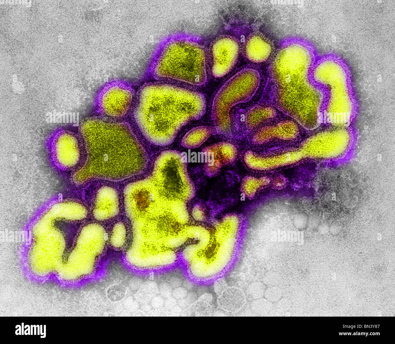 Transmission Electron Schliffbild (TEM) des Virus A/New Jersey/76 (Hsw1N1), eine Art von Schweinegrippe-virus Stockfoto