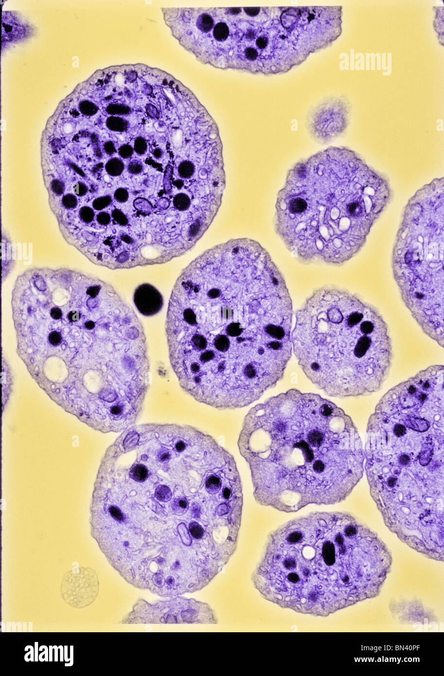 Getriebe-Elektronenmikroskop (TEM) Bild der menschlichen Thrombozyten Stockfoto