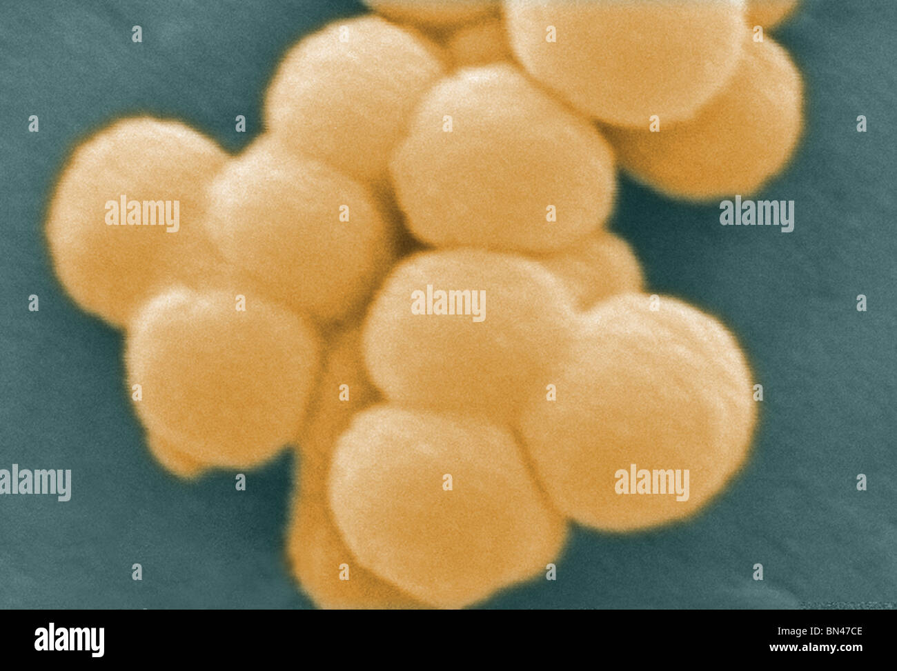Scanning Electron Schliffbild (SEM) einer gruppierten Gruppe von Gram-positiven, Beta-hämolytischen Streptokokken der Gruppe C-Bakterien Stockfoto