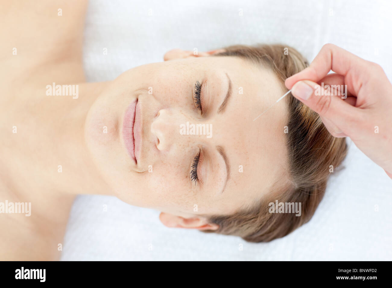 Akupunkturnadeln auf eine entspannte Frauenkopf Stockfoto